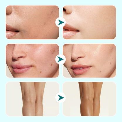 🌸Voorjaarsuitverkoop🌸 Hydraterende Waterdichte Concealer Crème voor Vrouwen