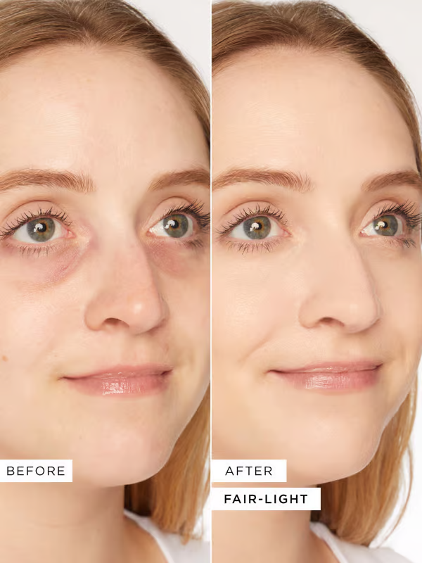 🔥HEETE VERKOOP 💖Oogverhelderaar, donkere kringen onder de ogen bedekken en verhelderen