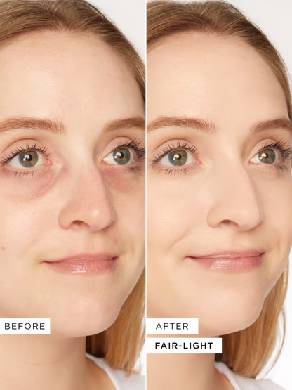 🔥HEETE VERKOOP 💖Oogverhelderaar, donkere kringen onder de ogen bedekken en verhelderen