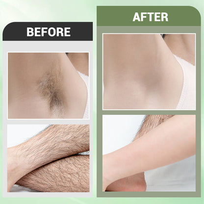 💖Uitverkoop 50% Korting💖3-delige ontharingscrèmeset voor het hele lichaam