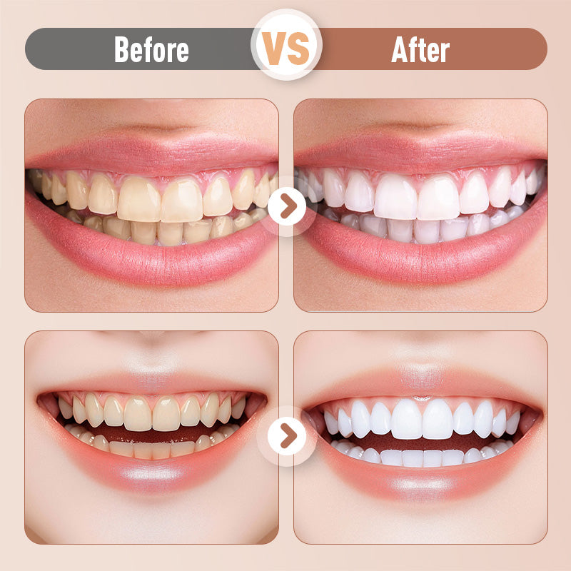 Rechargeable Sonic Electric Toothbrush For Adults