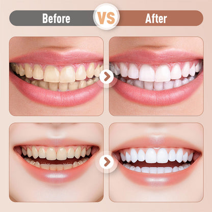 Rechargeable Sonic Electric Toothbrush For Adults